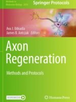 Axon Regeneration by Udvadia