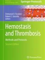 Hemostasis and Thrombosis by Favaloro