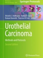 Urothelial Carcinoma by Hoffmann