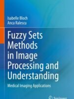 Fuzzy Sets Methods in Image Processing and Understanding by Bloch