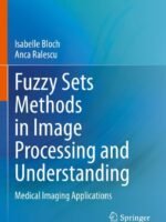 Fuzzy Sets Methods in Image Processing and Understanding by Bloch