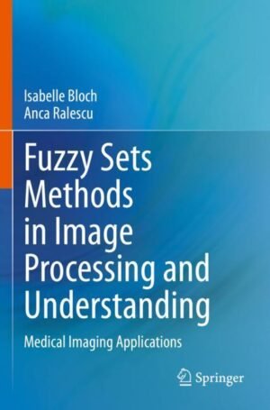 Fuzzy Sets Methods in Image Processing and Understanding by Bloch