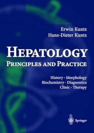 Hepatology, Principles and Practice